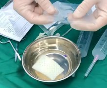 ADM生物补片：材料真相+案例全拆解