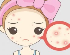 激光祛痘印的危害与效果?这些雷区要警惕!