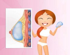 伊思雅和曼托假体：价格揭秘,看完这篇不踩坑