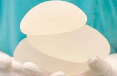 德国宝俪假体多少钱?影响因素揭晓啦