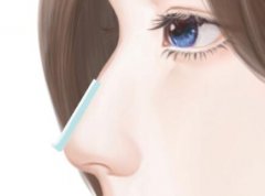 做软骨隆鼻有后遗症吗？价格大揭秘