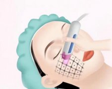 舒适热玛吉和4代哪个好?真人经验对比来啦