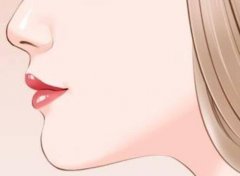 鼻基底填充和法令纹填充区别在哪?区别看这里