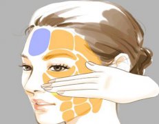 苹果肌填充|隐藏费用面诊时一定要问！