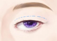 罗勇做双眼成还是赵忠芳好？实力大比拼来啦