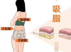 腹部去皮去脂环切术多少钱？看完这篇能省不少