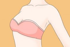 乳头整形手术大概多少钱？不同项目收费差这么多？看完不踩坑