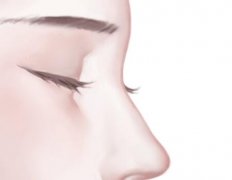 如何收缩鼻头毛孔？无效退款级收缩妙招大公开